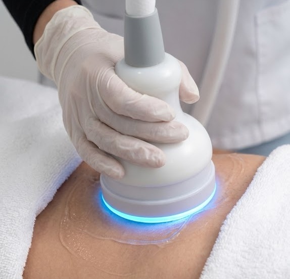 Cryotherapy at Recovery Lab
